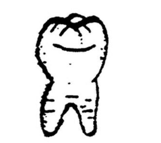 Scale Structures 2373 HO Large Tooth Dentist's Sign